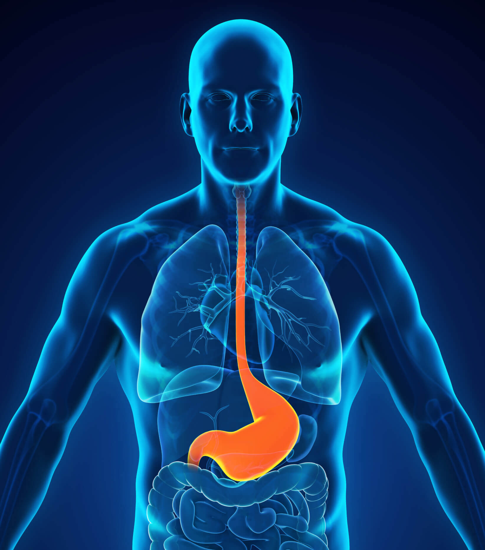 acid reflux